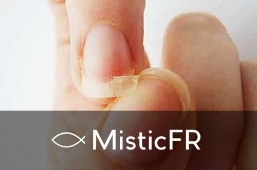 Rêver d'un ongle cassé