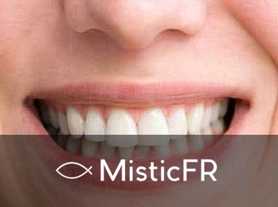 Rêver de dents qui s'effritent