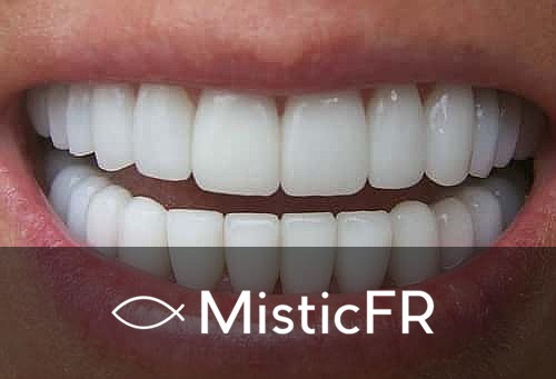 Rêver de dents sales